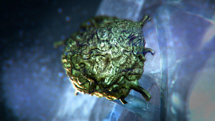 Acanthamoeba  - pasożyt ten może dostać się do organizmu przez błony śluzowe, np. przy wkładaniu soczewek kontaktowych do oka brudnymi mi rękoma. Wywołana przez tego pasożyta choroba, akantameboza, może doprowadzić do ślepoty, a także do śmierci