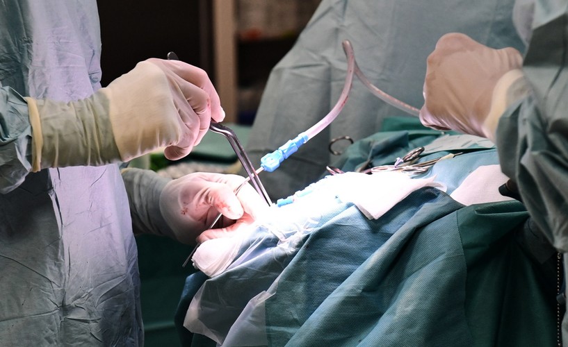 OPERACJA NA MÓZGU. TAK LECZY SIĘ PADACZKĘ LEKOOPORNĄ W SZCZECINIE