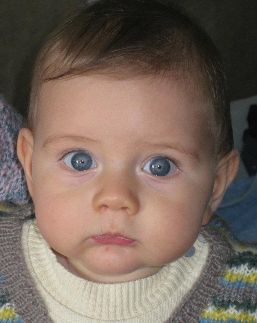 Malom Sergeju neophodna je hitna operacija u inostranstvu