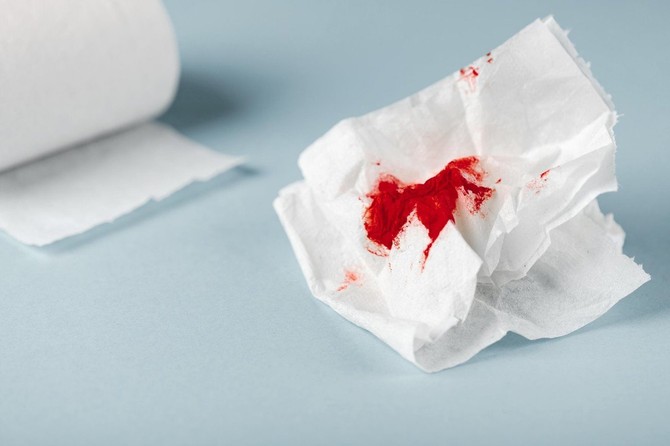 Nekada se u urinu mogu javiti i tragovi krvi što se naziva hematurijom. Ona uvek traži dodatno ispitivanje