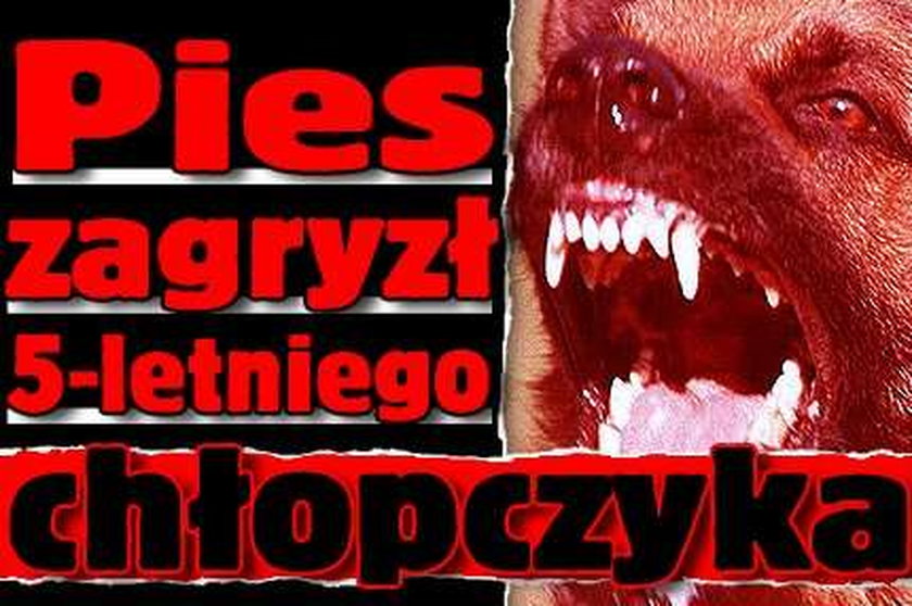 Pies zagryzł 5-letniego chłopczyka