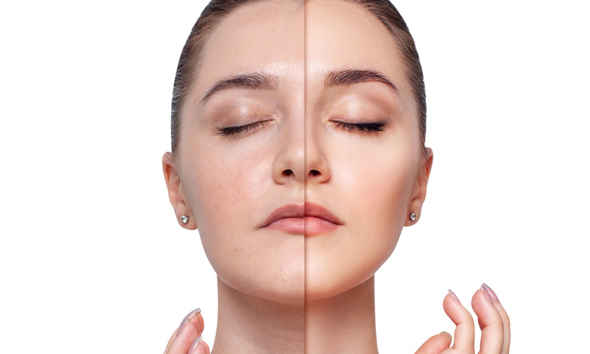 Ten krem CC zapewnia lekkie krycie, a do tego ma świetny filtr SPF. Upiększa cery z grudkami, krostkami i zaskórnikami