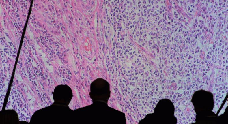 Cancer cells are seen on a large screen connected to a microscope at the CeBit computer fair in Hanover, Germany, March, 6, 2012.