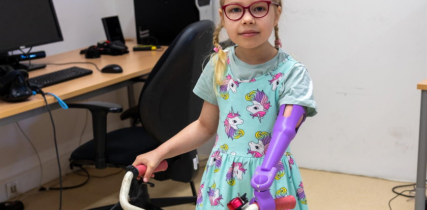 Zosia dostała nową rączkę. Naukowcy z Poznania chcą, by każdy mógł wydrukować protezę z drukarki 3D