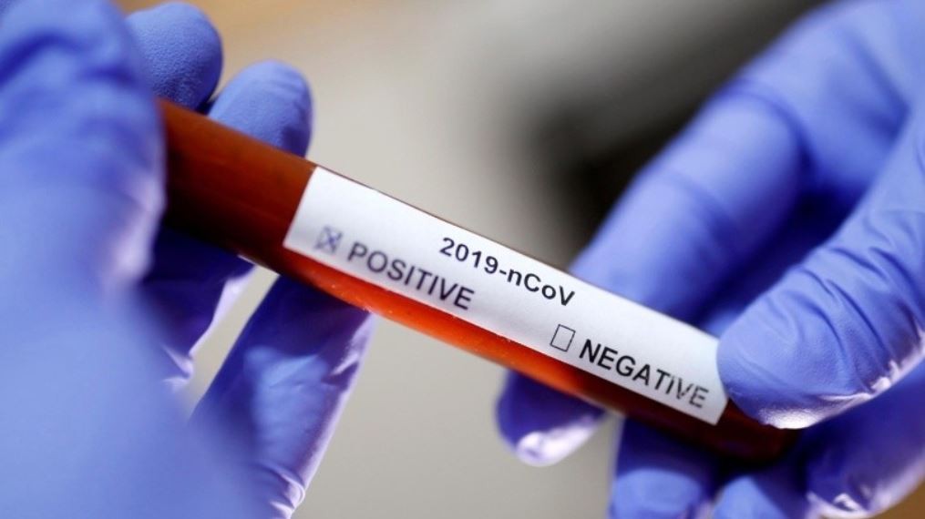 Laboratory technician holds up a Covid-19 positive sample in a vial (Reuters)