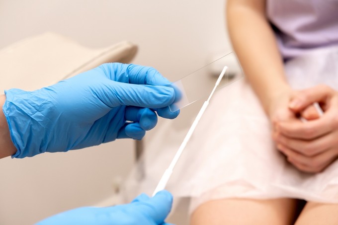 A Candida hogyan terjed, és mivel szüntethető meg? Az orvos válaszol