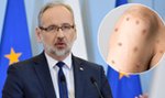 Pilne! Minister Niedzielski: Mamy pierwszy przypadek małpiej ospy w Polsce