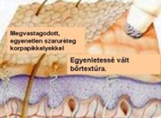 bor-mikroderma-d0000143038f417fbabd1
