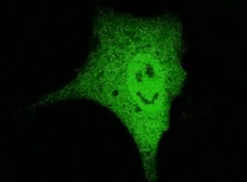 Protein je od ćelijskog jedra napravio "smajlija"