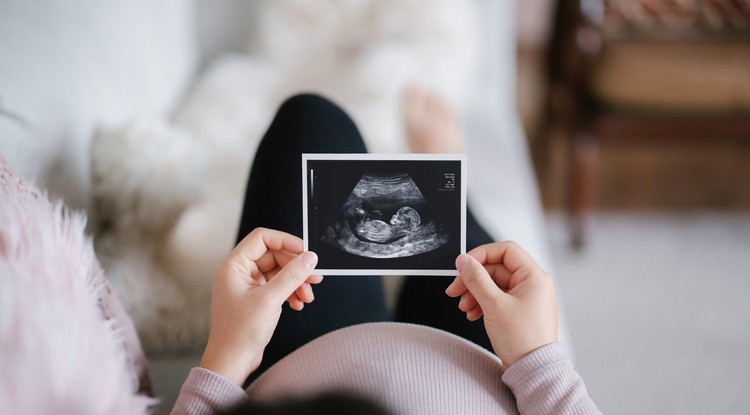 Fotó: Getty Images-1332283908