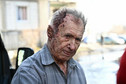 Ranny mężczyzna po atakach bombowych na Czuhujew