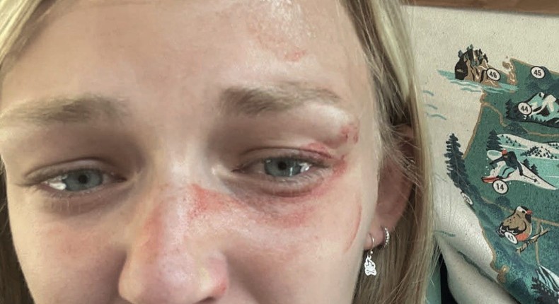 A selfie of Gabby Petito taken on August 12, 2021 at 4:37 a.m. was released by attorneys for her parents Tuesday to prove that Utah police ignored signs of Brian Laundrie abusing their daughter.Parker and McConkie Law Firm