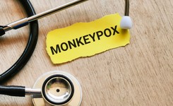 'Małpia ospa przenosi się znacznie trudniej niż Covid-19. Ale zachorować może każdy'