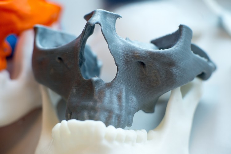 POLSCY NAUKOWCY DRUKUJĄ TRÓJWYMIAROWE MODELE KOŚCI