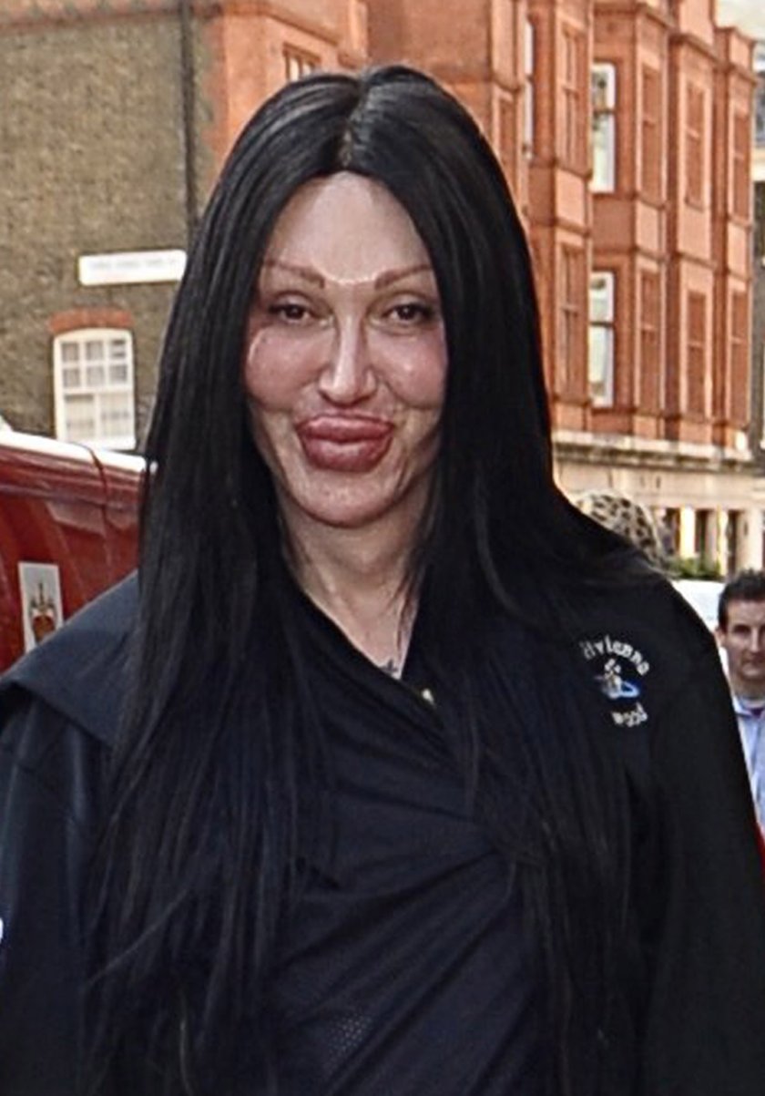 Pete Burns