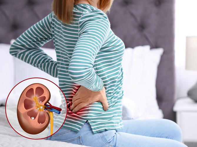 Bubrezi su vitalni organi koji igraju važnu ulogu u očuvanju našeg zdravlja. Kad obole, trpi čitav organizam