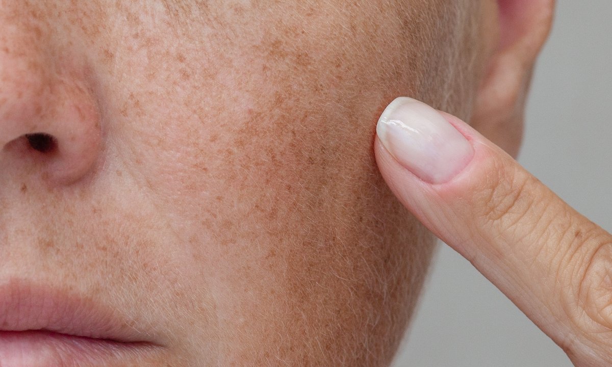 Dojrzałe kobiety oszalały na punkcie tego serum! Ściera plamki z twarzy w 14 dni