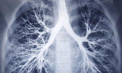 Podstępna choroba płuc. Co trzeba wiedzieć o POChP?