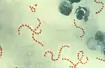 Streptococcus pyogenes