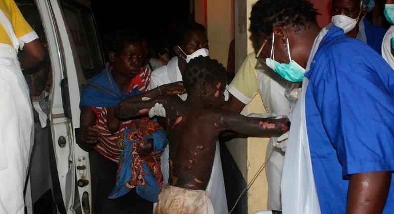 A badly burned child arrives at the Provincial Hospital in Tete on November 17, 2016, after a truck carrying petrol burst into flames