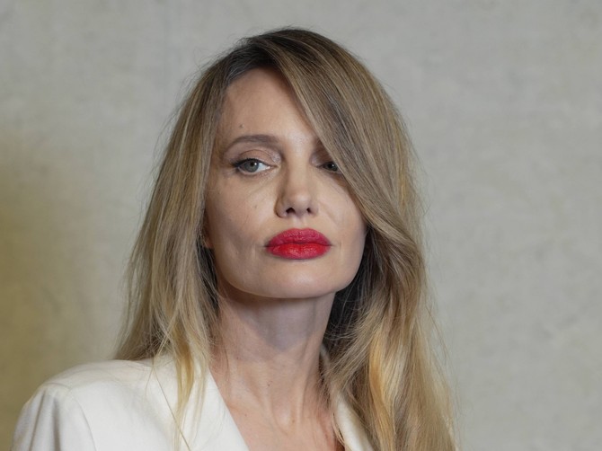 Novo lice Anđeline Džoli alarmiralo i doktore: "Da li je imala šlog?"