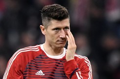 Lewandowski z podbitym okiem. Zobacz, jak Polak został sponiewierany w meczu Ligi Mistrzów