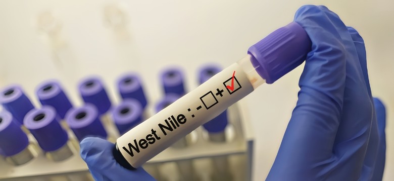Słynny immunolog zakażony wirusem Zachodniego Nilu