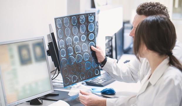 Nova studija, objavljena u časopisu JAMA, otkrila je da loše mentalno zdravlje može da bude jedan od najranijih znakova multiple skleroze