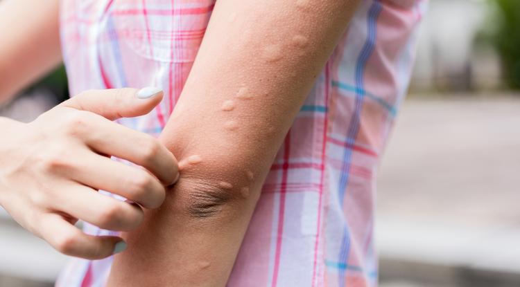 Szuper házi szer szúnyogok ellen Fotó: Getty Images