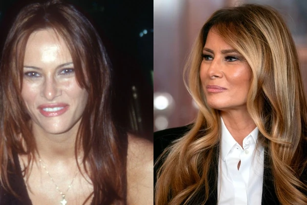 Otkrivena TAJNA RASKOŠNOG VOLUMENA: Kako je Melanija Tramp rešila problem TANKE I PROREĐENE KOSE - iza glamuroznog izgleda krije se JEDNOSTAVAN TRIK