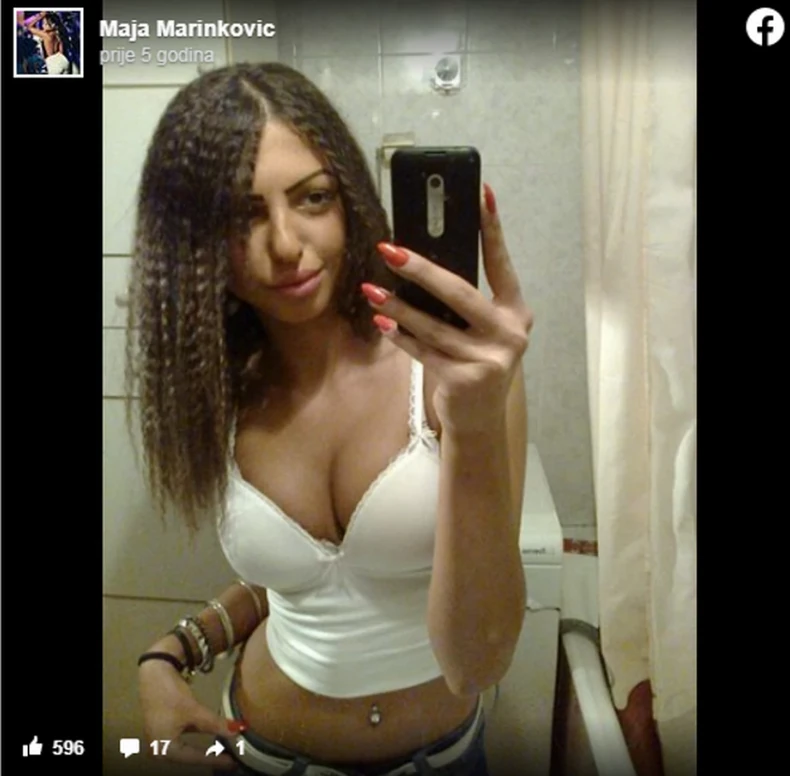 Maja Marinković pre operacija