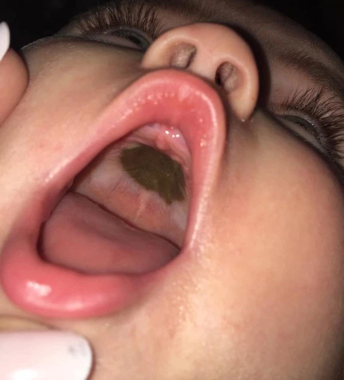 Majka je sliku okačila na Fejsbuk