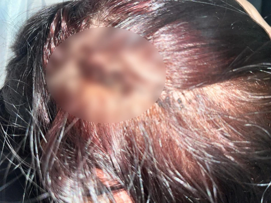 Pretučena Srpkinja u Beranama