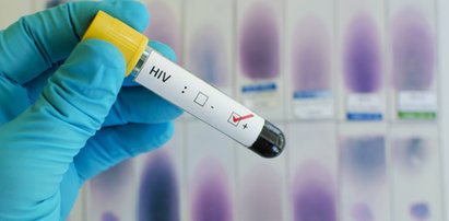 Straszne informacje z Łodzi. Aż 14 razy wzrosła tam liczba zakażeń... HIV! Dlaczego?