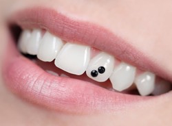 Uśmiech pełen diamentów. Niebezpiecznie modne zęby