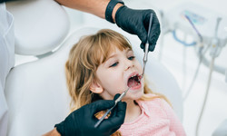 Jak rozpoznać początki próchnicy? Dentystka: zęby mleczne można leczyć