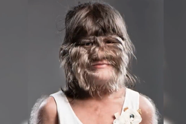 "Najdlakavija devojka na svetu" se RAZVELA OD MUŽA kog je zvala "ljubavlju svog života": Obrijala je sve dlake s lica i pokazala NOVOG DEČKA