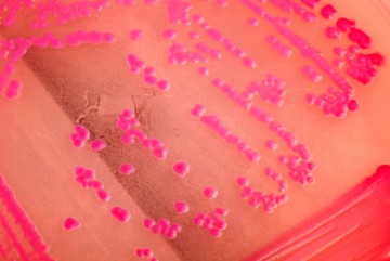fertőző baktérium Helicobacter pylori nyombélfekély tünete sok sav gyomorrák