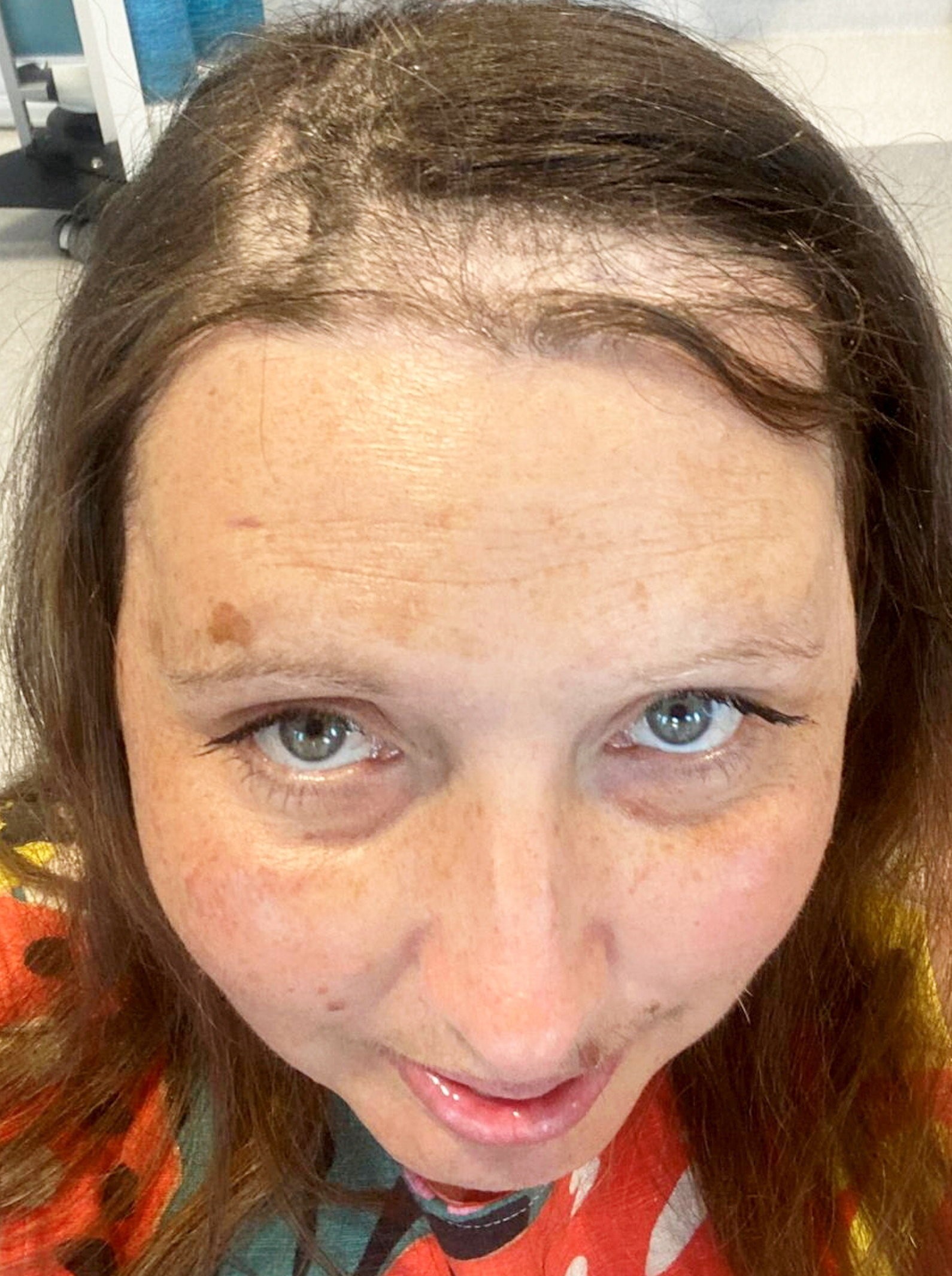 Lizzie Pitt bojuje naďalej a hľadá nové možnosti liečby.