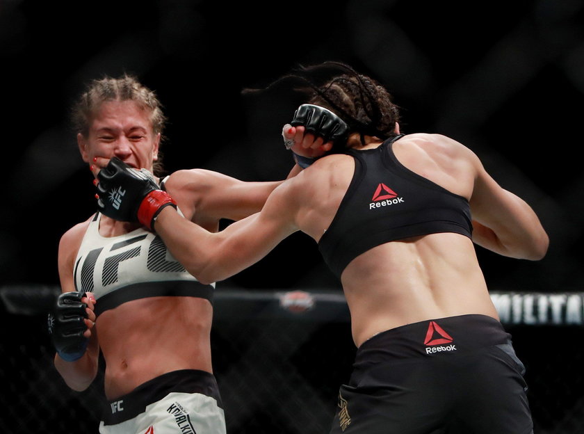 Joanna Jędrzejczyk w szpitalu po walce z Karoliną Kowalkiewicz w UFC