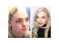 Kanadyjska transseksualistka pokazała od kuchni operację zmiany twarzy. FOTO + WIDEO