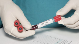 SARS-CoV-2 jak HIV? Wirusolożka ostro o &quot;teorii&quot; niemieckiego ministra zdrowia