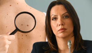 Prof. dr Danica Tiodorović, predsednica Udruženja dermatovenerologa Srbije 
