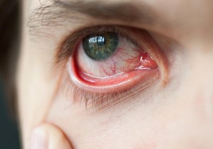 sorti_5_razloga_da_posetite_lekara_vesti_blic_safe_sto