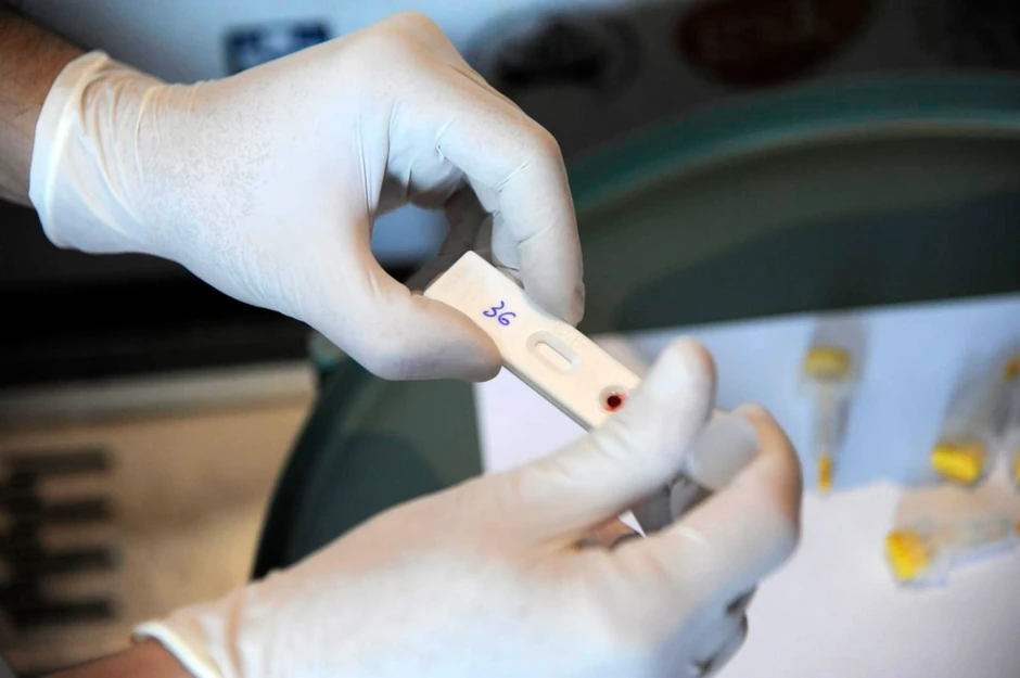 hiv testiranje