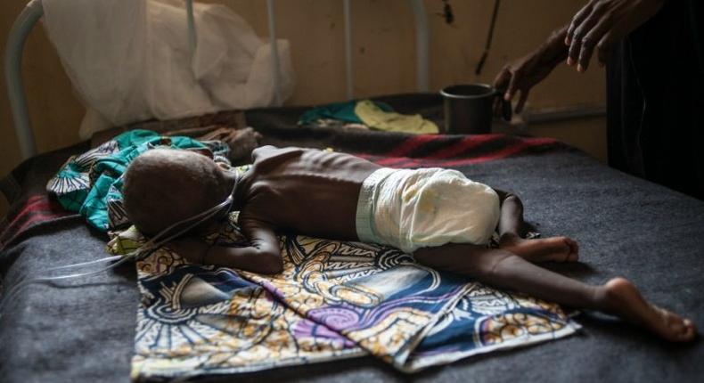 A young child suffering from severe malnutrition is treated at the In-Patient Therapeutic Feeding Centre in Maiduguri, northeastern Nigeria, on September 17, 2016