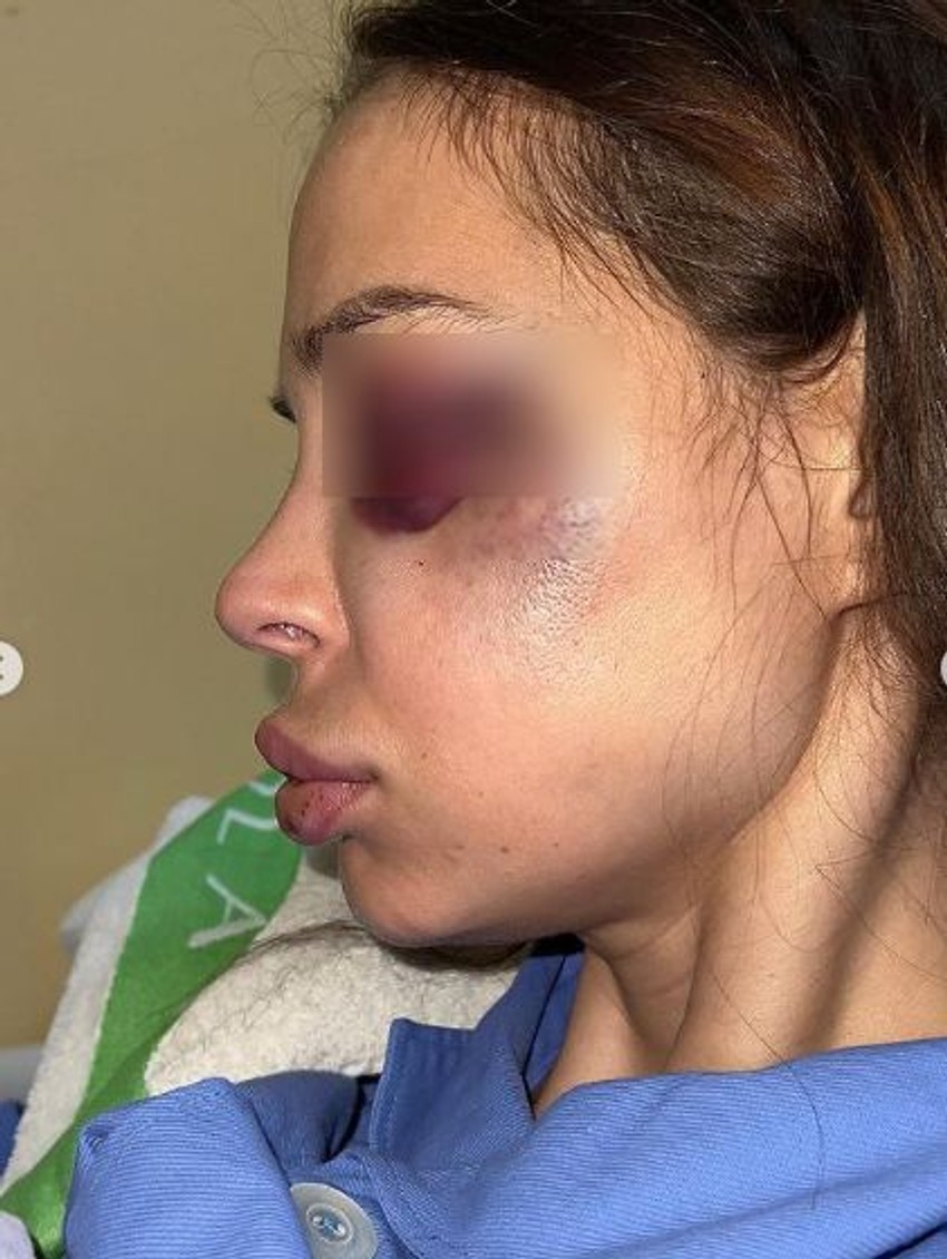 Nataša Šavija pretučena