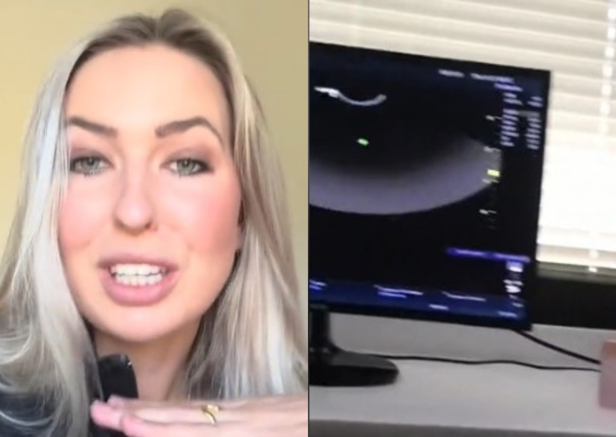 Anja je rođena sa dve vagine,