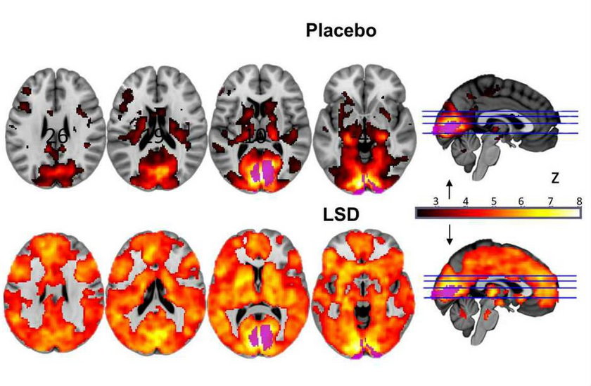 lsd