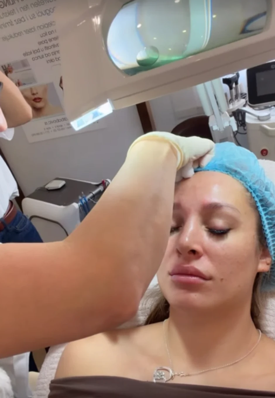 Luna Đogani ubrizgava botoks u lice